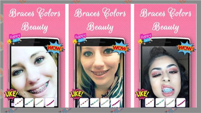 Braces Colors Beauty -Behel Kamera Android